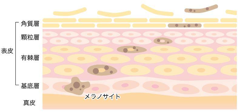 ターンオーバー正常化