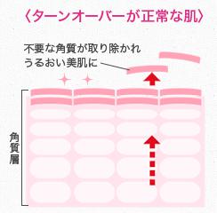 ターン オーバーを正常化するには