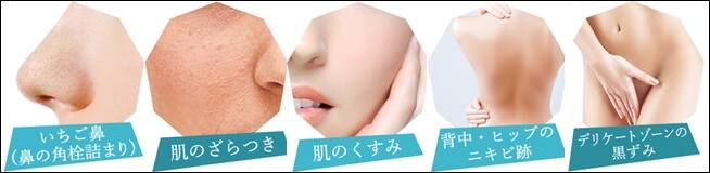 メラニン毛穴 治し方 美容皮膚科